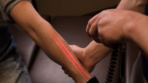 Chiropractor using laser therapy
